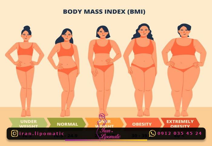 نکات مربوط به BMI