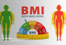 نکات BMI