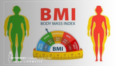 نکات BMI
